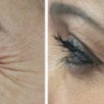 Wie mag injectables geven?
